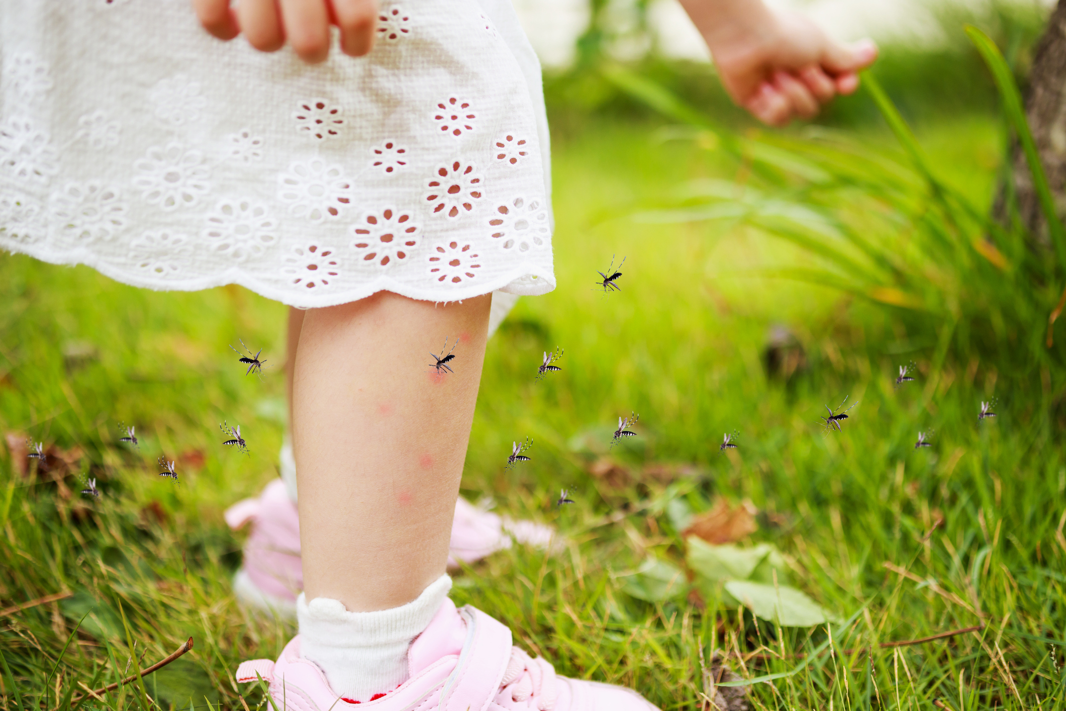 Ребенка покусали комары и мошки: как снять зуд, отек и боль