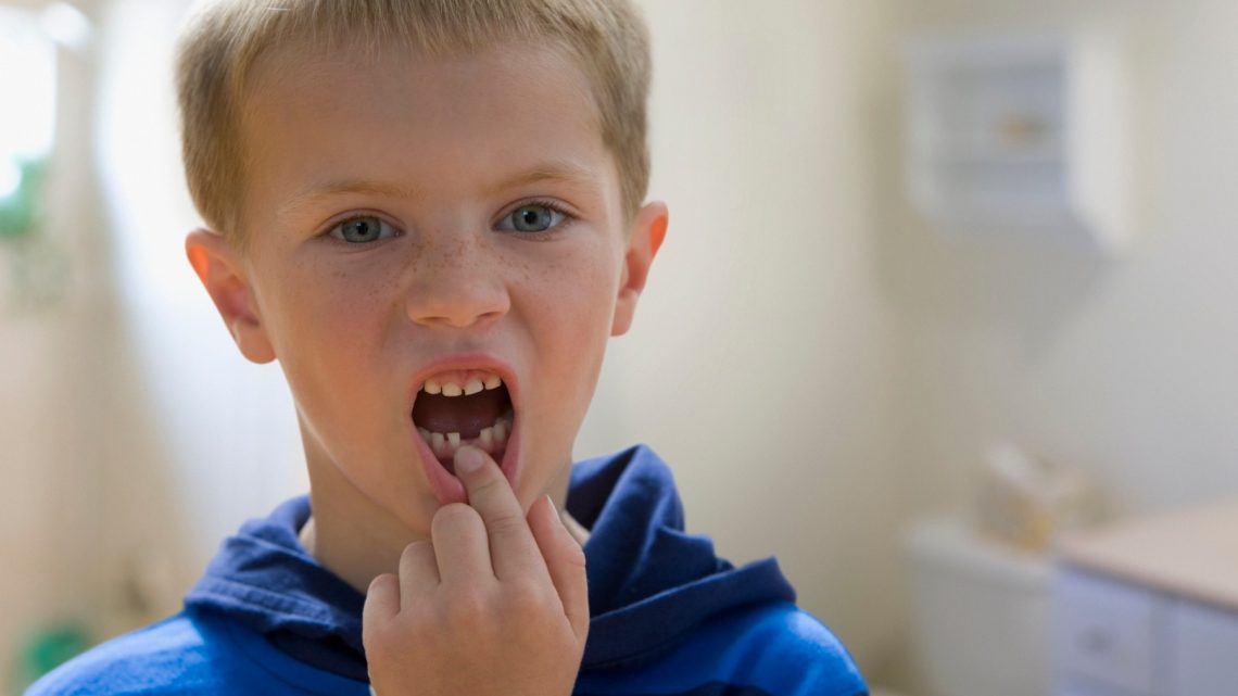 Детские зубные травмы: что делать родителям
