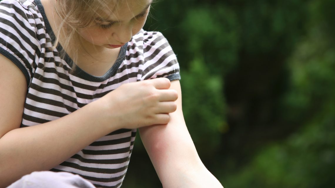 Ребенка укусил комар: когда это повод бежать к врачу