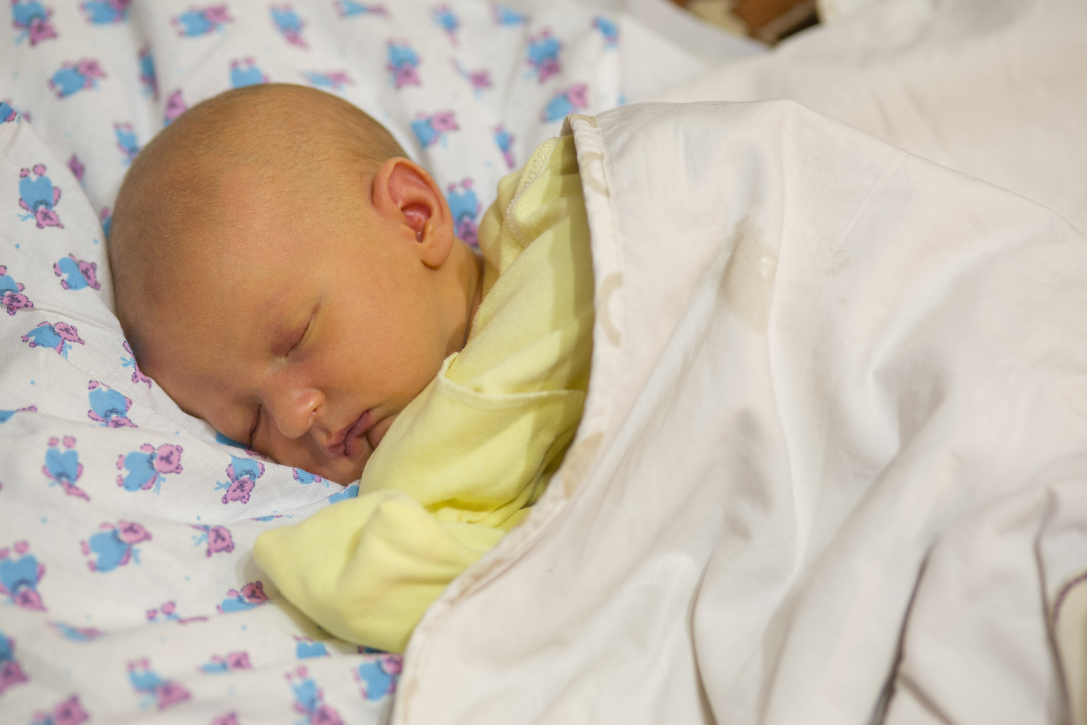 желтушка у новорожденных, фото, причины, когда должна пройти, лечение, последствия
