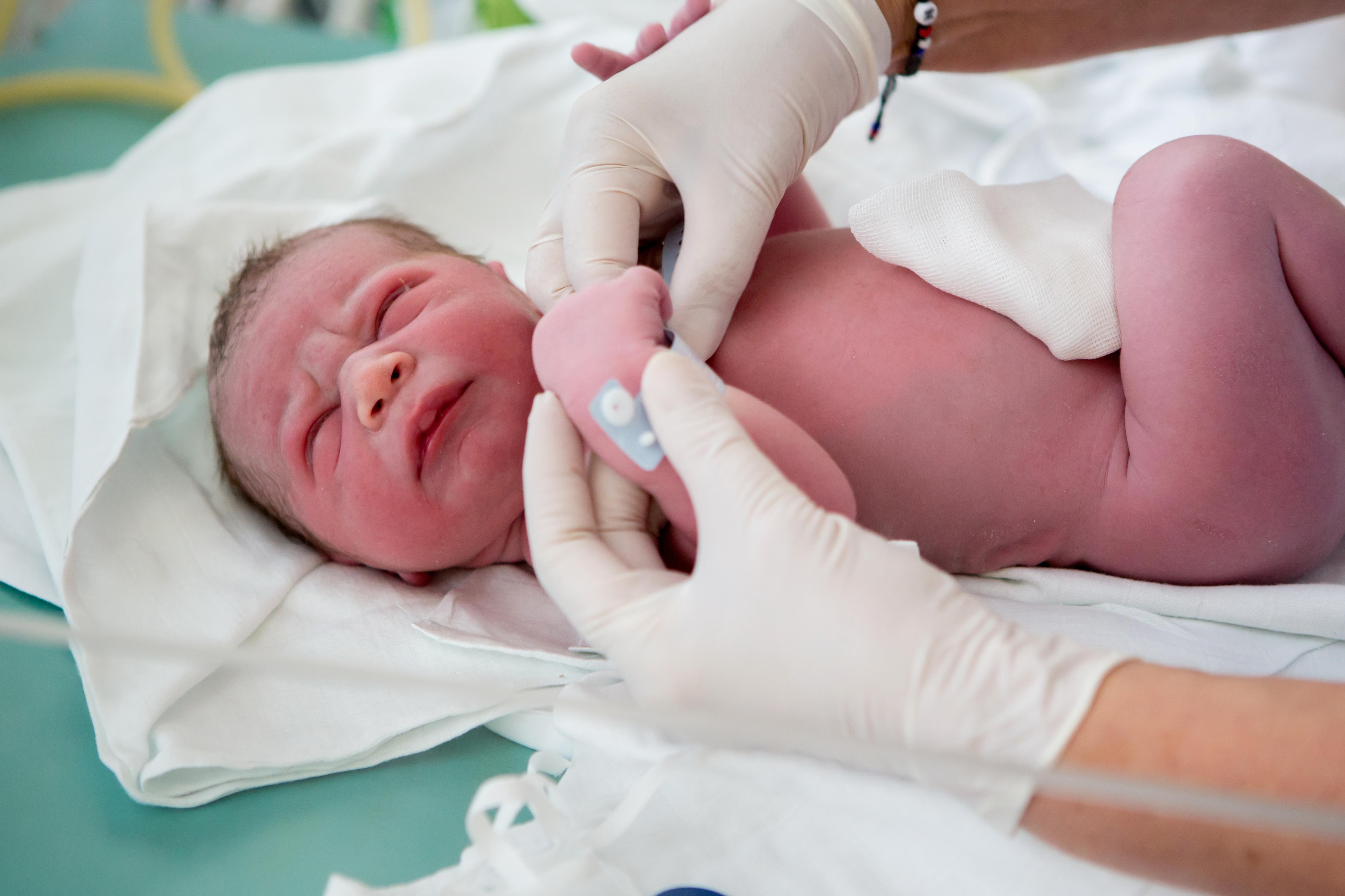 Фото №3 - 50 оттенков синего: почему у новорожденного кожа нездорового оттенка