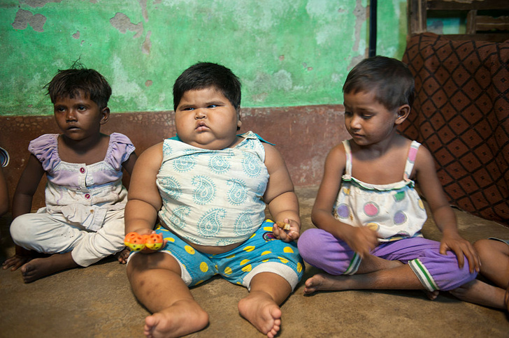 Крохи-тяжеловесы: 7 самых больших детей в истории