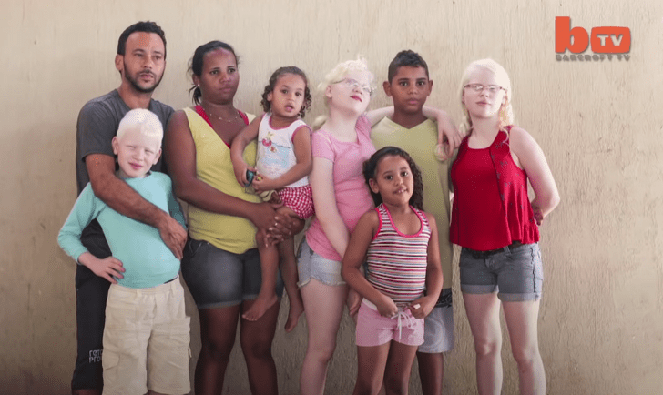 Семья альбиносов, Бразилия, Пернамбуко