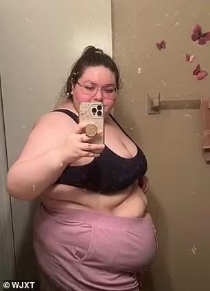 «Как будто беременна сразу десятью»: двадцатилетней американке удалили кисту яичника весом в 45 кг